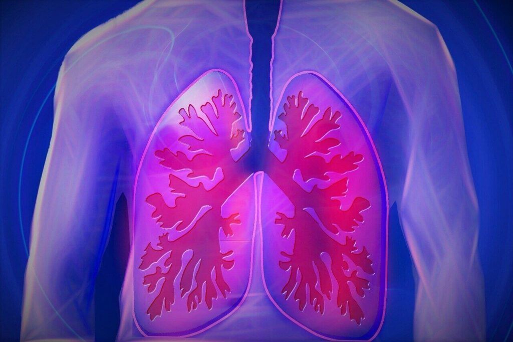 Câncer de pulmão